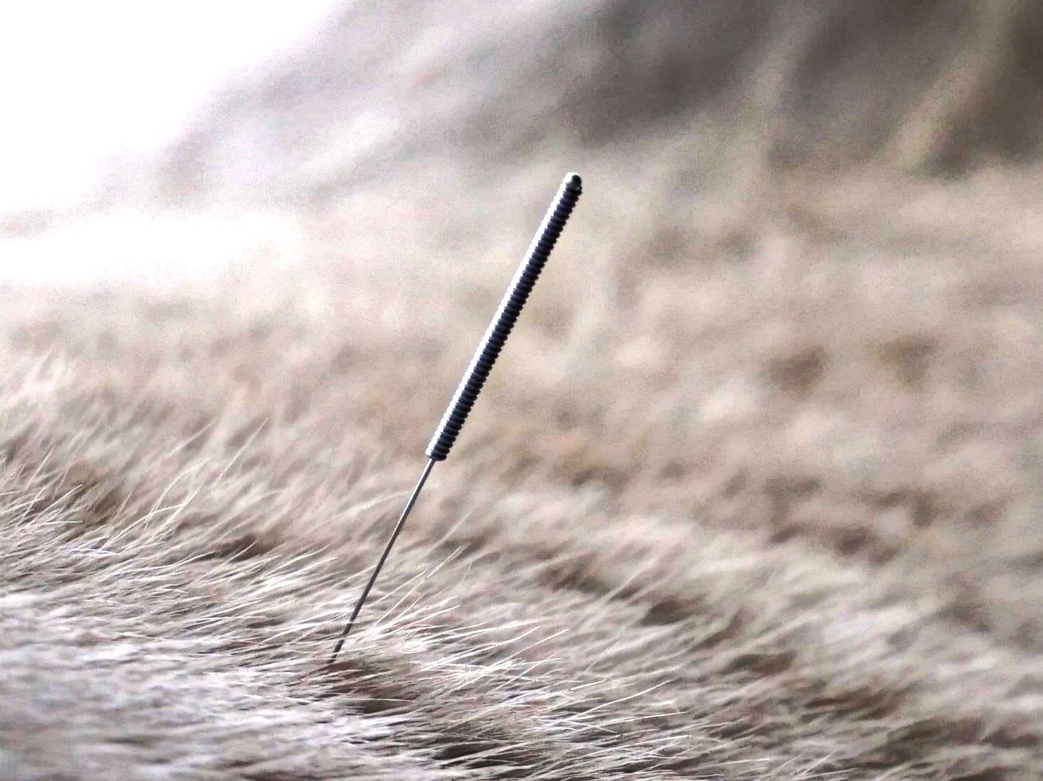 Dry Needling - Triggerpunkt-Therapie
